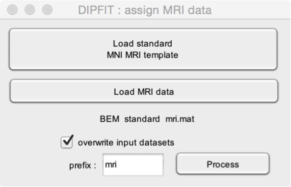 dipfit_load_mri