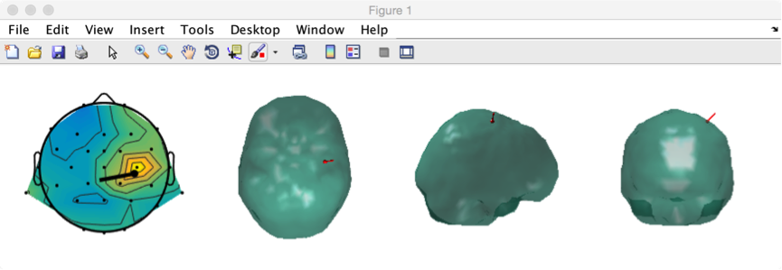 dipfit_view_dipoles_window