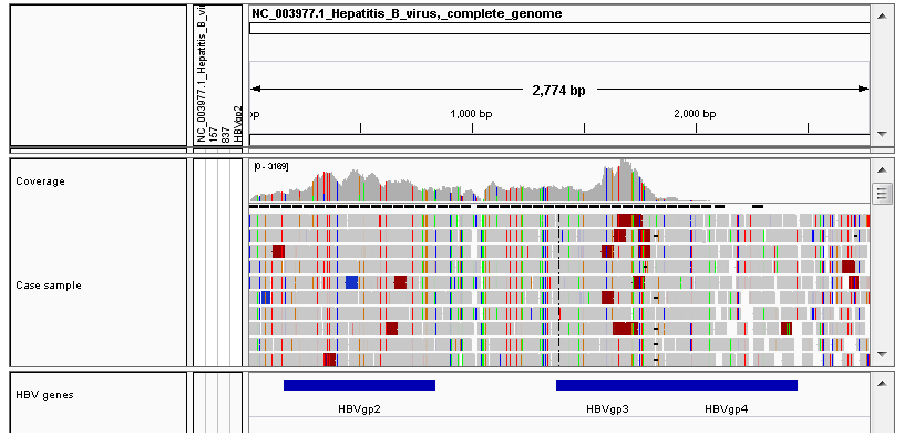 Virus_detection_HBV_IGV.png