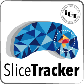 SliceTracker.png