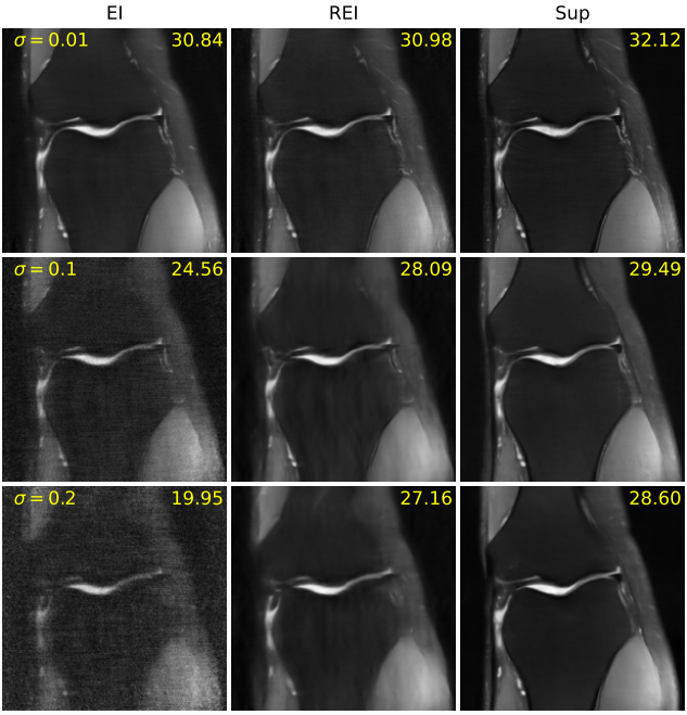 fig1_mri.png