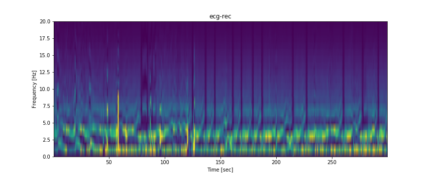 ecg_rec_spec.png