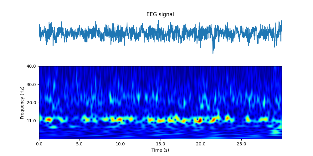 eeg2.png