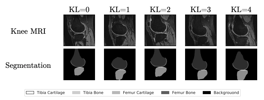 Data-KneeOA.png