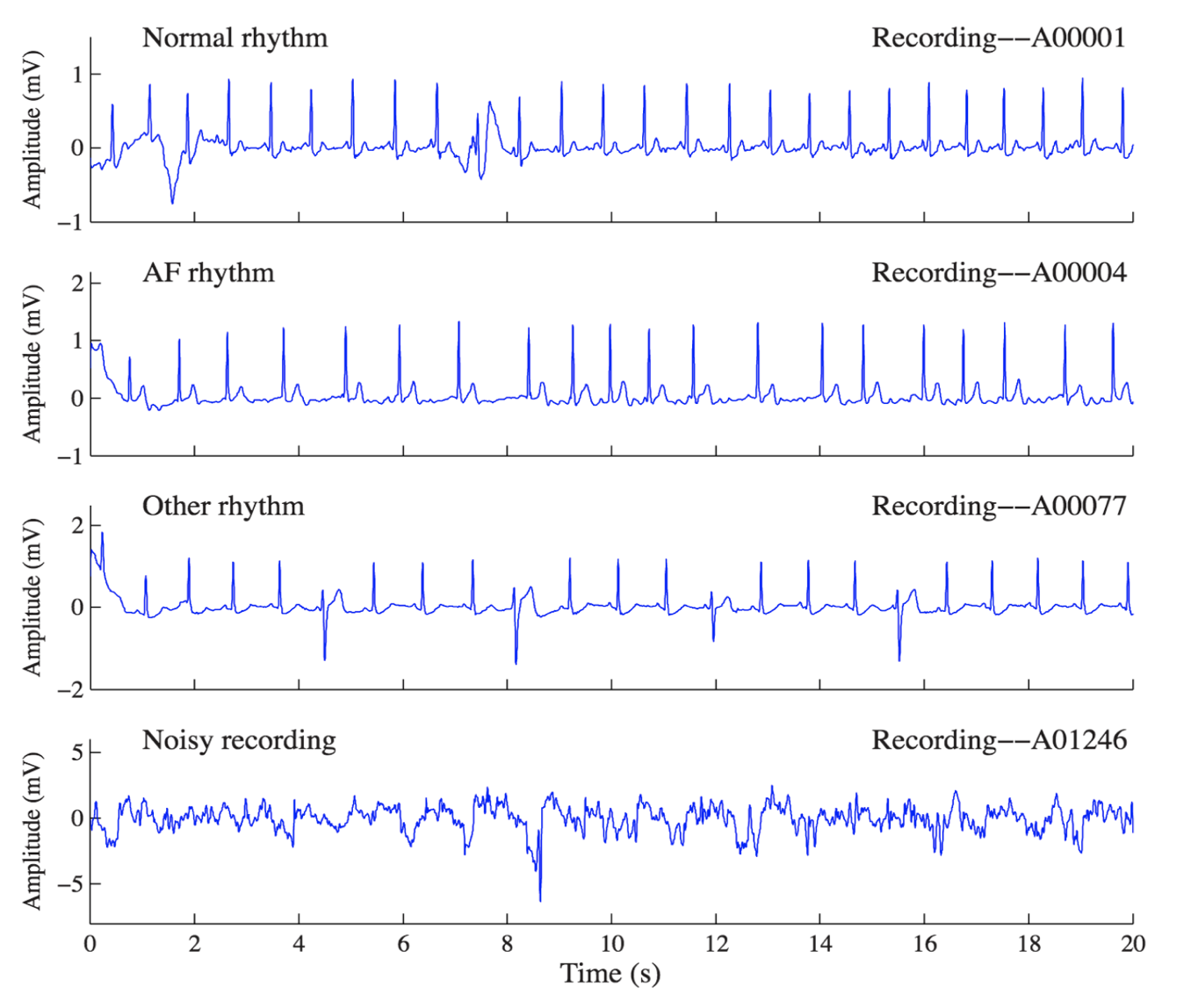 ecg_new.png