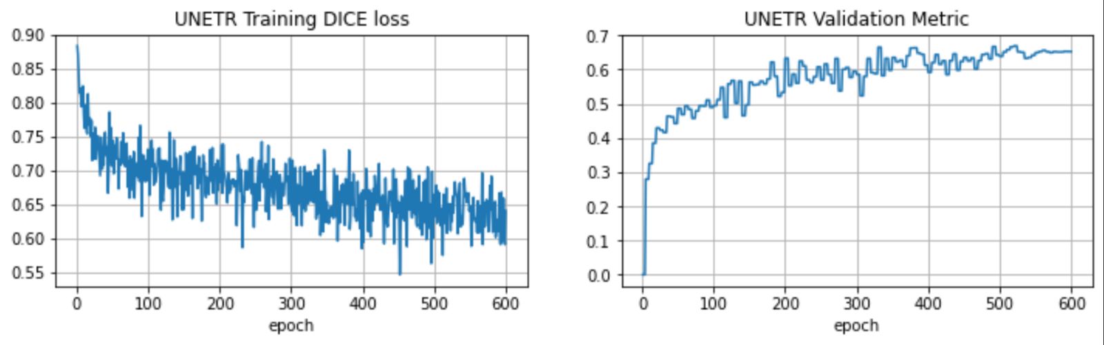 unetr_loss_plots.jpg