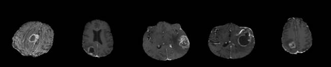 axial-mri.jpg