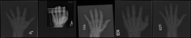 x-ray-rheumatology.jpg